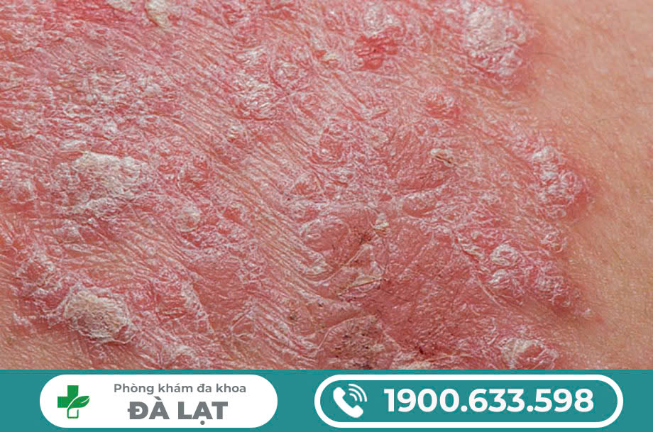 Hình ảnh minh họa